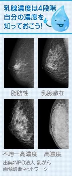 ヒアルロン酸豊胸の基礎知識 美容外科の医師監修コラム