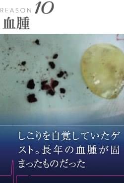 寿命を過ぎると危険 シリコンバッグ豊胸のトラブル10選 美容外科の医師監修コラム