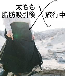 太もも脂肪吸引のダウンタイム経過報告 6ヵ月までの経過写真を公開 医師監修コラム