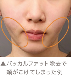 キツネラインを作る方法とは お悩み別小顔整形診断 美容外科の医師監修コラム The Clinic ザクリニック 公式