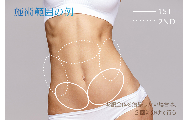 医療ダイエットの “お悩み別” おすすめ治療は? 〜効果・費用で比較