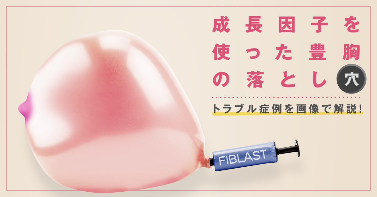 成長因子を使った再生豊胸の落とし穴 トラブル症例を画像と共に解説