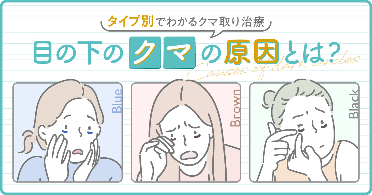 目の下のクマ取りはどれがいい タイプ別でわかる原因と治療法 美容外科の医師監修コラム The Clinic ザクリニック 公式