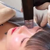 切らずにたるみを強力引き締め！モフィウス8徹底解説！