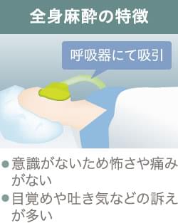 静脈麻酔と全身麻酔の違いは 脂肪吸引で気になる麻酔の種類