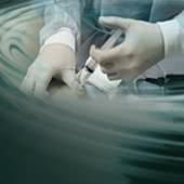 脂肪吸引時の麻酔方法について解説【静脈麻酔と全身麻酔の違いは?】