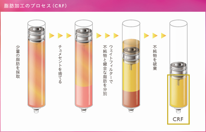 脂肪加工のプロセス