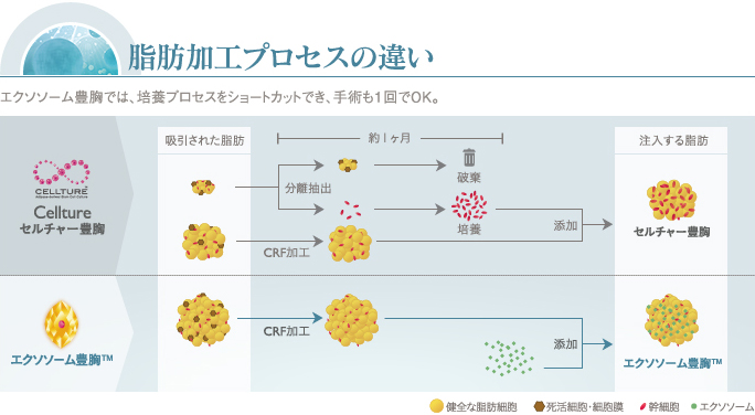 セルチャー豊胸とエクソ―む豊胸の加工プロセス比較