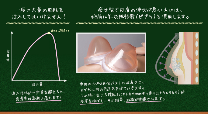 脂肪を定着させるための仕組み