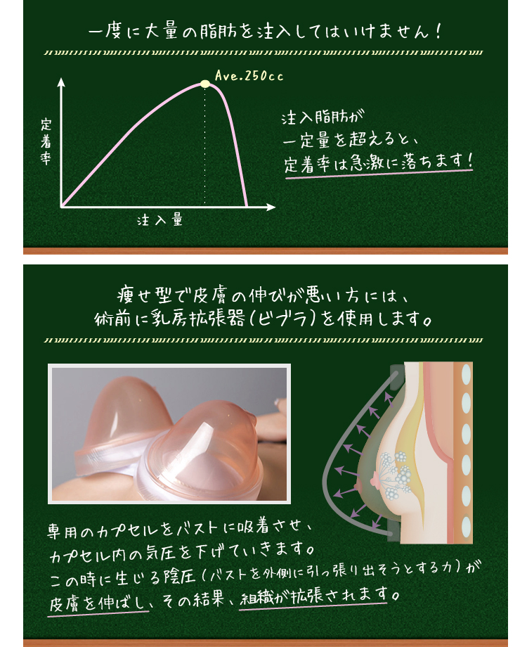 漏斗胸 ろうと胸 の女性必見 手術なしで胸のくぼみを改善する方法 美容外科の医師監修コラム
