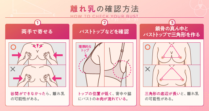 離れ乳の見分け方