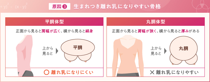離れ乳の原因③生まれつき