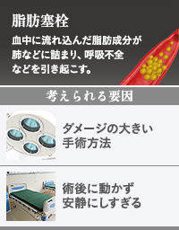 脂肪吸引による脂肪塞栓の原因