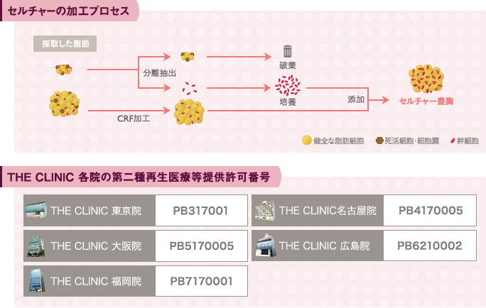 セルチャー豊胸（脂肪注入豊胸）の脂肪加工プロセス