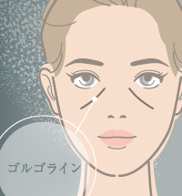 ゴルゴ線の配置