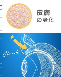 老け顔に終止符 目のくぼみ 三重まぶたの原因と治療法を解説