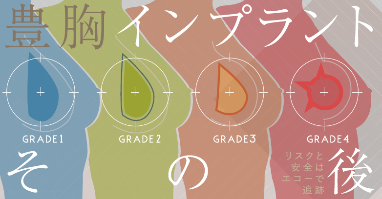 豊胸インプラントの“その後” ～リスクと安全は、エコーで追跡～