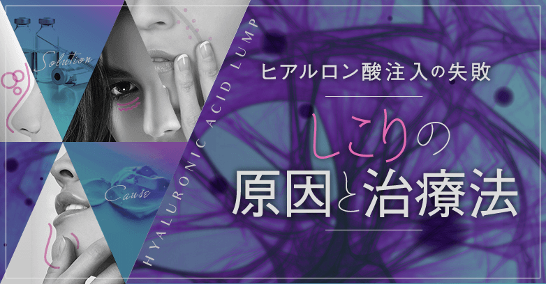 【顔ヒアルロン酸注入の失敗】しこりの原因と治療法