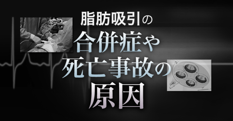 脂肪吸引の合併症や事故の原因 美容外科の医師監修コラム