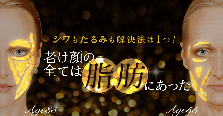 老け顔は改善できる!【原因と効果的なエイジング治療をご紹介】