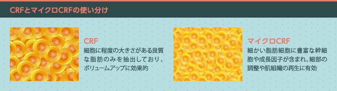 CRFとマイクロCRFの違い