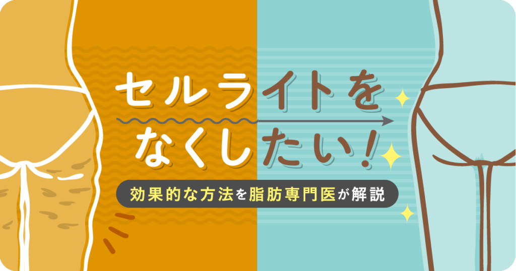 セルライト除去は自分でできるの? 脂肪専門医が原因となくす方法を解説