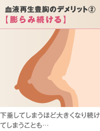 成長因子による血液豊胸（再生豊胸）のデメリット②「膨らみ続ける」