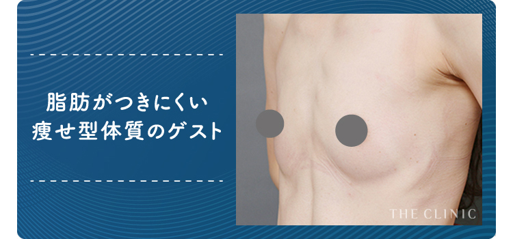 無乳　貧乳 貧乳・小胸さん必見! 胸に脂肪をつけるバストアップ法を脂肪専門医が伝授