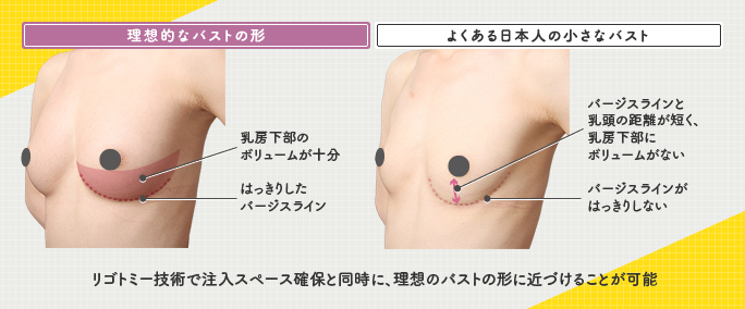 理想的なバストと日本人に多い小さな胸の特徴の違い