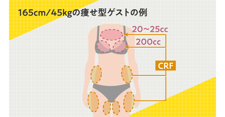 脂肪豊胸の​デメリット4選｜後悔しないために​知っておくべき対処法