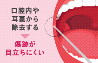 ジョールファット除去のメリット