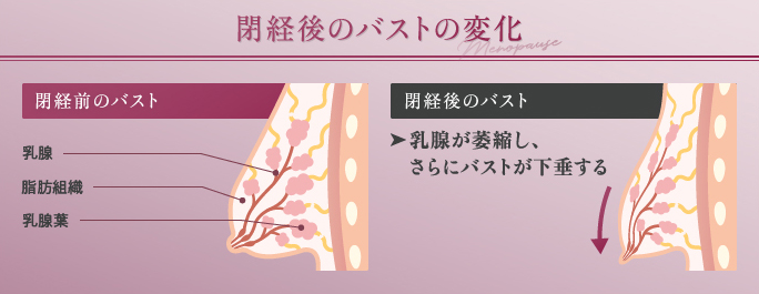 閉経後のバストの変化