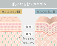 肌がたるむメカニズム