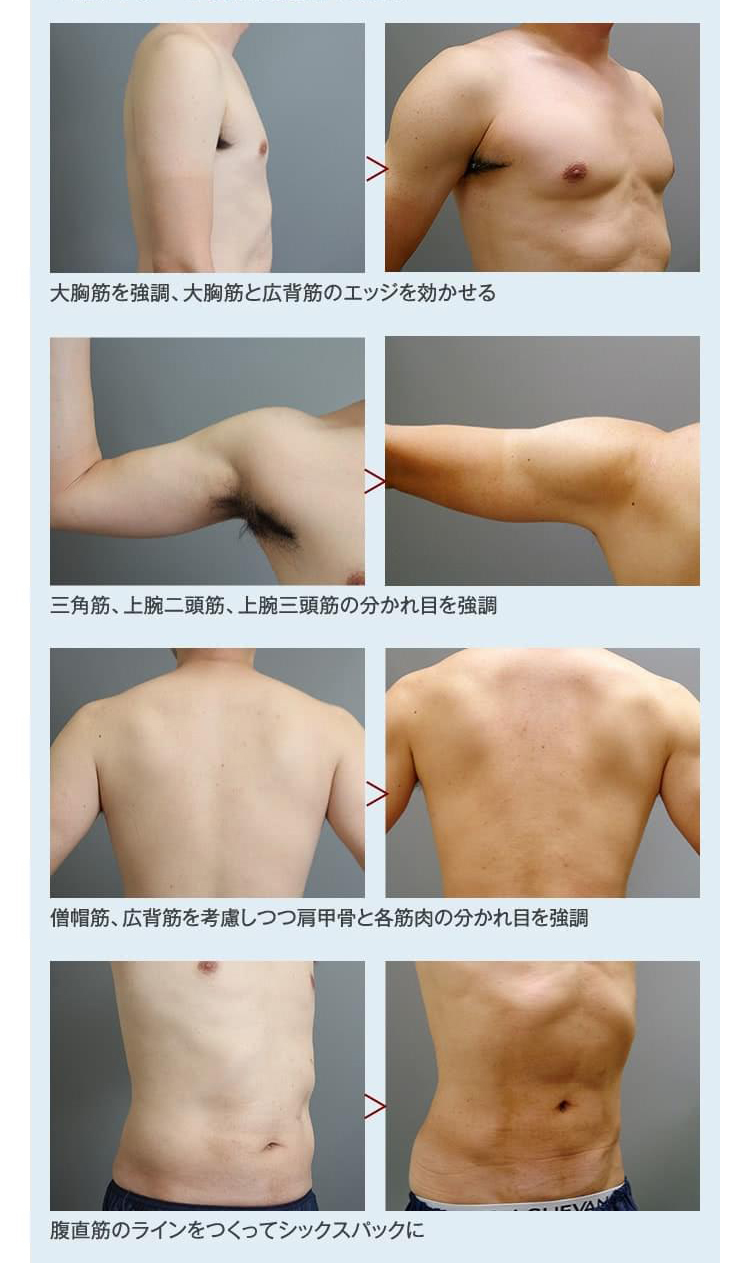 胸 の 脂肪 男