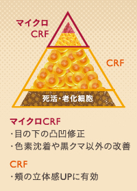 マイクロCRFとCRFの脱脂失敗修正の用途の違い