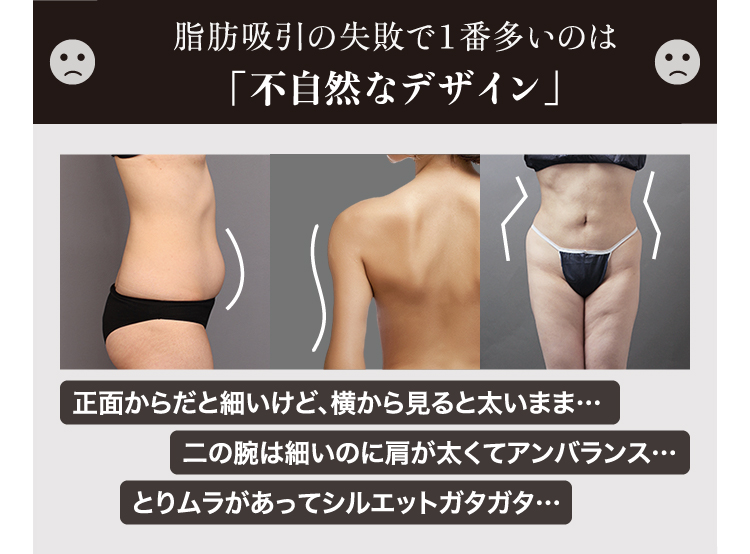 脂肪吸引で後悔しないために！よくある5つの失敗を画像で解説