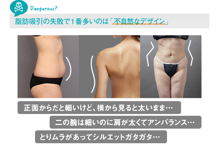 脂肪吸引の気になるリスクを美容外科医が解説!│美容外科の医師監修コラム