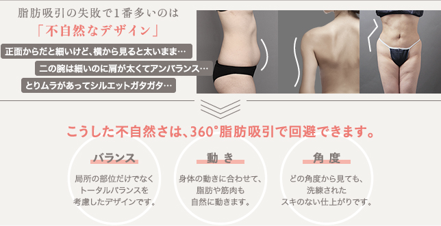 360脂肪吸引の概要
