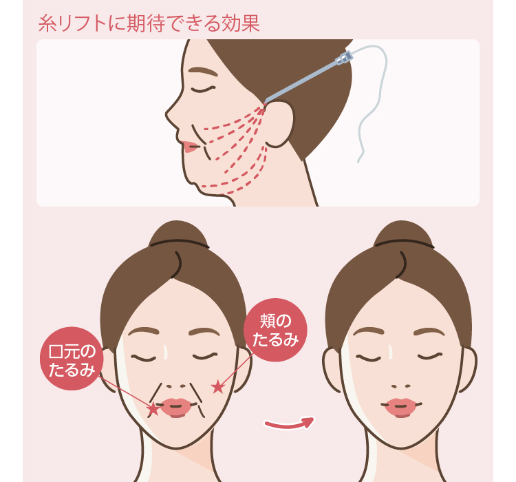 顔痩せ・小顔に効果的な筋トレ、マッサージ、美容施術｜THE CLINIC