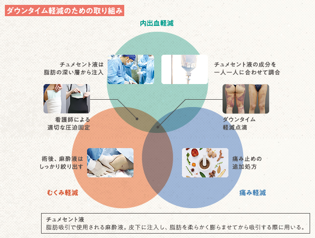 ダウンタウン軽減のための取り組み