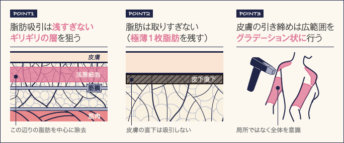 二の腕の脂肪吸引でたるみを防ぐための施術３ポイント