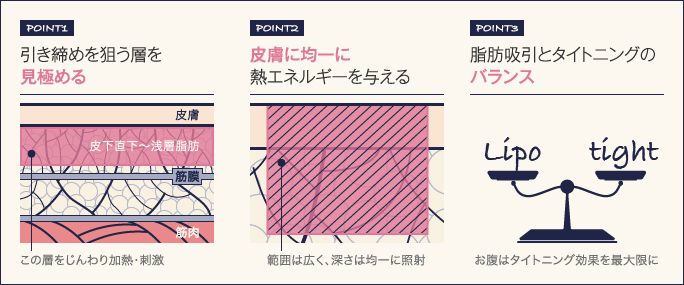 お腹の脂肪吸引で皮膚がたるむ失敗を回避する施術３ポイント