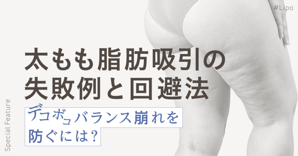太もも脂肪吸引の失敗例と回避法｜デコボコ・バランス崩れを防ぐには？