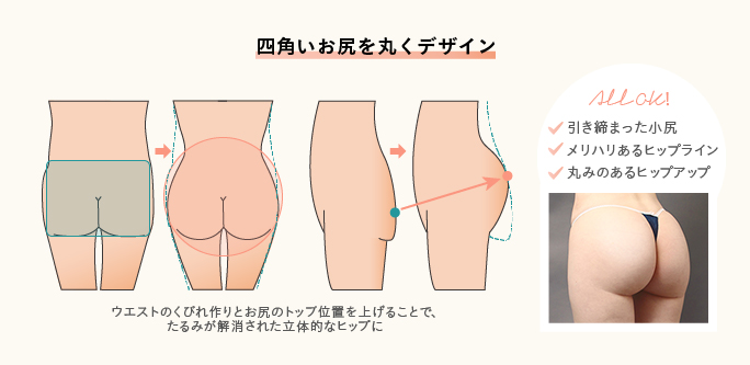 脂肪吸引や脂肪注入によるヒップメイクのポイント