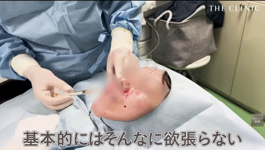 目の下のたるみ取りの修正のポイント