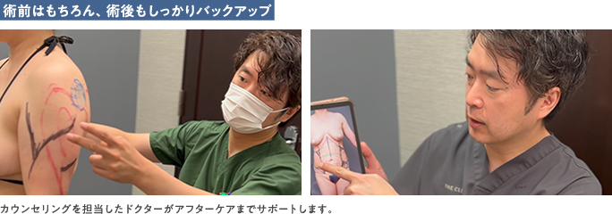 ザクリニック福岡の安部院長による脂肪吸引のカウンセリング