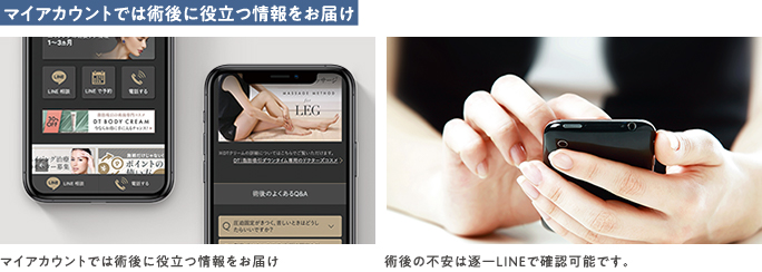 ザクリニックの脂肪吸引後の専用マイページとLINE個別相談