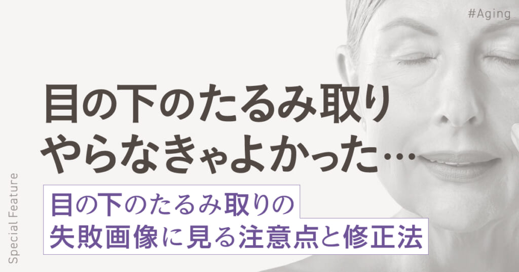 「やらなきゃよかった…」目の下のたるみ取りで失敗・後悔した人の症例画像と修正法