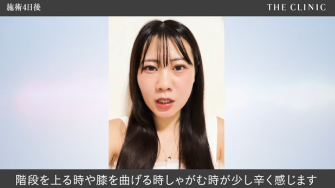 脂肪豊胸後4〜7日目の様子