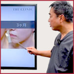 顔脂肪吸引のダウンタイムは何日ツラい？ピークや早く治す方法を解説